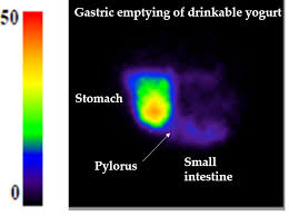Nutrients Free Full Text Gastric Emptying And Dynamic In Vitro Digestion Of Drinkable Yogurts Effect Of Viscosity And Composition Html