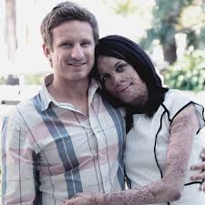 One of australia's most inspirational women, turia pitt makes cool stuff that will help you feel happier, and more confident. True Love Ex Model Turia Pitt 1africa