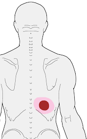 Pin On Low Back Front Pain