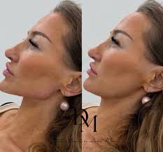 Aesthetic Beauty by Daria Morris (@aestheticbeautybydariamorris) •  Instagram photos and videos