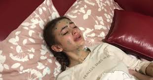 Varicele vene varicoase recenzii și preț. S A Molipsit De VaricelÄ Iuliana Beregoi A Filmat Un Vlog Despre BoalÄ Stiri Md Stiri Md