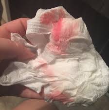 Has anyone had pink discharge in early pregnancy perhaps a little too late for implantation and gone on to have a baby? 8w2d Light Pink Spotting Just One Wipe And Nothing More But This Is The 3rd Time In The Last 2 Weeks That It S Happened No Cramping Or Anything But My Doc Appointment
