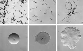 Image result for Erysipeloid