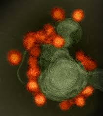 New Evidence Supports Biological Link Between Zika Infection Guillain Barre Syndrome