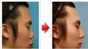 Potongan rambut pendek memiliki berbagai macam model dan disesuaikan dengan bentuk wajah. Tanpa Operasi Ini 6 Cara Alami Bikin Hidung Jadi Mancung Citizen6 Liputan6 Com