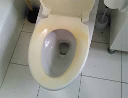 What Causes Yellow Stains On A Toilet Seat