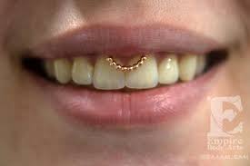 Smiley Piercing With An Oaktier Seamless Ring In Rose Gold By Bvla Piercing By Me Smiley Piercing Piercing Mouth Piercings