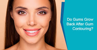 Most likely they will not grow back, but it might be worth the wait, time permitting of course. Do Gums Grow Back After Gum Contouring Bristol Dental Clinic