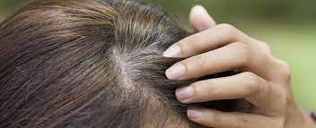 Depending on what's causing your lady locks to thin or fall out, there are a variety of options to help women with hair loss. Age Related Hair Loss