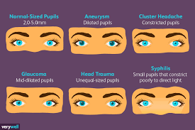 Pupil Size And Your Health