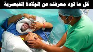 اسباب الولادة القيصرية قائمة بأهمها