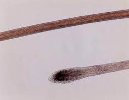 Each hair on the human scalp is divided into a hair shaft that protrudes from the skin and a hair for more information on microscope manufacturers, use the buttons below to navigate to their websites Fbi Deedrick Forensic Science Communications January 2004