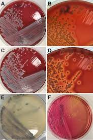 Aureus grow on mannitol salt agar. Fig 1 Journal Of Clinical Microbiology