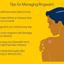 Hand sanitizers are a convenient way to clean your hands when soap and water aren't available. How Ringworm Is Treated
