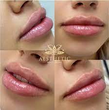 600 central ave ste 311 highland park, il 60035 $100 off any dermal filler send to your phone frequently asked questions about aesthetic beauty lounge what forms of payment are accepted? Premier Aesthetic Center Aesthetic Beauty Lounge Highland Park Il
