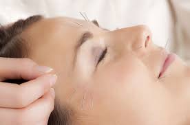 Most people with bell's palsy recover fully — with or without treatment. Acupuncture Facial Recovery For Bell S Palsy
