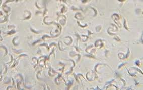 Image result for Lannea antiscorbutica