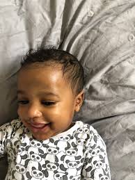 Due to their difference in texture and length, baby hair vellus or baby hair is quite different from the terminal hair that grows on your scalp. Coconut Oil Bad For Babies Hair July 2018 Babies Forums What To Expect