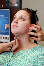 First FDA-approved fat cell injection does away with double chins