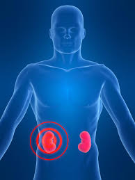 Heart failure, renal failure, eclampsia also are the factors, worsening prognosis. Acute Kidney Failure Spain Pdf Ppt Case Reports Symptoms Treatment
