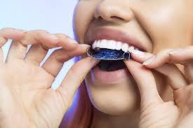 Retainer — ein retainer ist ein zahn stabilisator, der im rahmen einer kieferorthopädischen behandlung eingesetzt wird. Orthodontist In Charleston Sc Removable Or Permanent Retainer