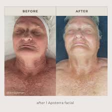 Aloe, Rose Petal and Pink Clay Facial Bar Soap