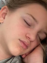 What remedies and advice can help a college student recover from COVID-19?