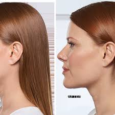 THE BEST 10 Weight Loss Centers near UNIONTOWN, OH 44685