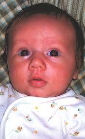 Wreck injures Bonifay woman