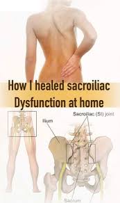 Sacroiliac Joint Dysfunction Is Quite Common Nowadays Especially Women Experience This Kind Of Scia Sacroiliac Joint Dysfunction Si Joint Dysfunction Si Joint