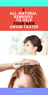 On The Head Of Hair Thinning Crown Women Click On The Image For Additional Details Hairlosstreatme Hair Loss Solutions Hair Loss Treatment Grow Hair Faster