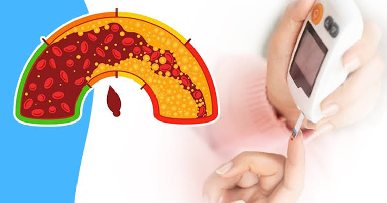 Cách kiểm soát mỡ máu để hạn chế rối loạn cương dương