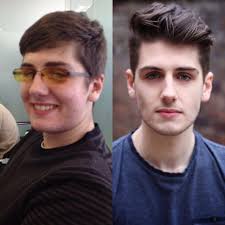 16 20 18kg Weight Loss Roaccutaine And A Haircut Can Do A Lot The Glasses Are Red Now Uglyduckling