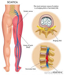 We did not find results for: What Are The Different Causes Of Gluteus Pain With Pictures
