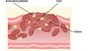 Image result for Platelet Dysfunction