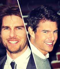 Tom cruise's smile is able to steal every woman's heart. Tom Cruise Before And After Braces Hoyt Dental Murrieta Temecula Dentist Orthodontics Oral Surgery