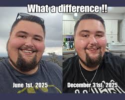 Weight loss after gastric sleeve surgery