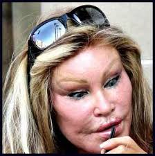 Can you finance plastic surgery if you have bad credit? Plastic Surgery Gone Bad For Jocelyn Wildenstein Bad Celebrity Plastic Surgery Celebrity Plastic Surgery Plastic Surgery
