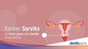 Check spelling or type a new query. Ingin Deteksi Kanker Serviks Berapa Biaya Pap Smear Dan Iva Cek Di Sini