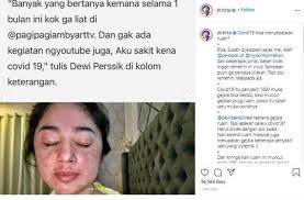 Tubuh Dewi Perssik Muncul Ruam Karena Corona Dokter Tirta Jangan Remehkan Matamata Com