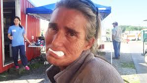 To boost job prospects, younger Americans seek dentures