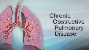 Hie Multimedia - Chronic Obstructive Pulmonary Disease (Copd)