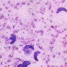 Image result for Balantoides Coli