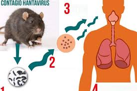 Virus particles, or virions, of a hantavirus known as the sin nombre virus (snv). Hantavirus Causes Symptoms And Treatment
