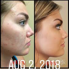 Stacy Niemi (@niemi.stacy) • Instagram photos and videos