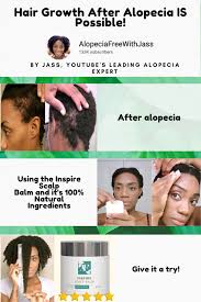 Hair Restore Biotin Hair Growth Serum Inspire Scalp Balm Alopecia Free Shop Alopecia The Balm How To Grow Natural Hair