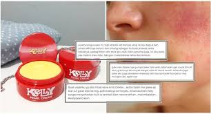 Baru baru ni viral pasal cara macam mana nak test produk kecantikan kita tu ada merkuri ke tak cara nk check ada merkuri or tak, 1. Pro Kontra Krim Kelly Yang Katanya Bahaya Masalahnya Masih Banyak Yang Suka