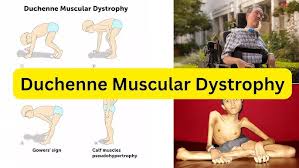 Image result for Muscular Dystrophy