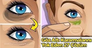 Kuru Ve Esmer Tenli Kisilerde Daha Sik Gorulen Goz Alti Kararmalarini Yok Edebileceginiz Dogal Tarifler Hazirladik Gozlerin Altindaki Koyu Halkalar Sagli Iphone