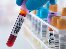 We did not find results for: Nucleic Acid Amplification Test For Stds